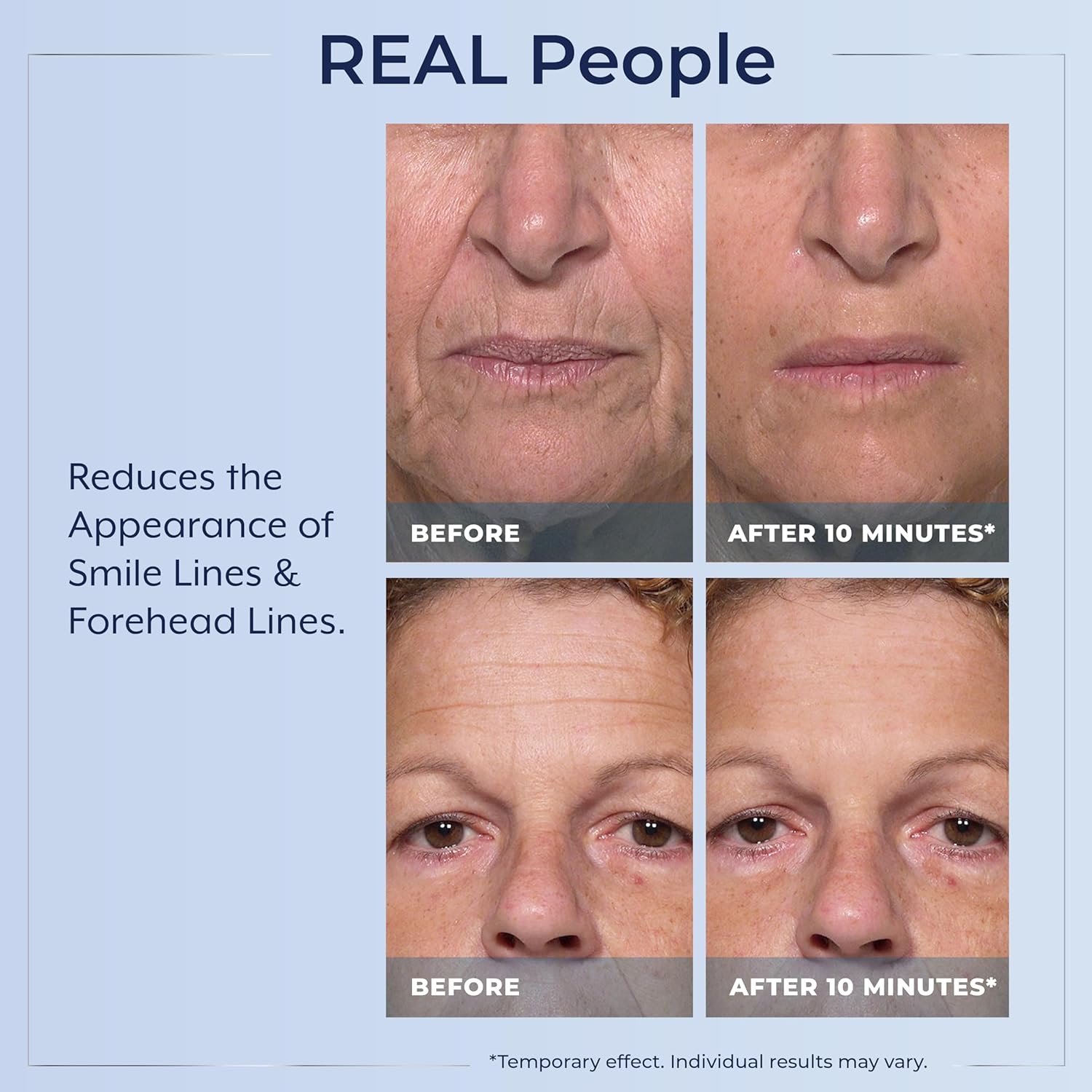 Plexaderm Rapid Reduction Eye Serum - Visibly Reduces Under-Eye Bags, Wrinkles, Dark Circles, Fine Lines & Crow's Feet Instantly, Anti Aging Wrinkle Remover for Face, Full Size Tube - Image 5