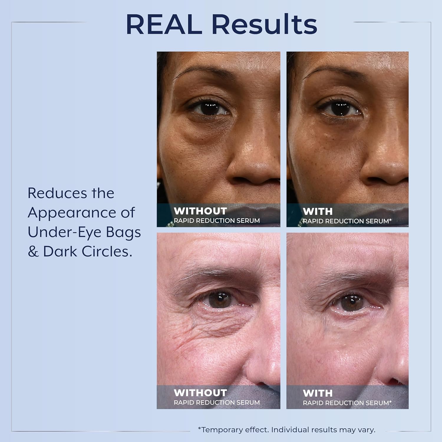 Plexaderm Rapid Reduction Eye Serum - Visibly Reduces Under-Eye Bags, Wrinkles, Dark Circles, Fine Lines & Crow's Feet Instantly, Anti Aging Wrinkle Remover for Face, Full Size Tube - Image 7