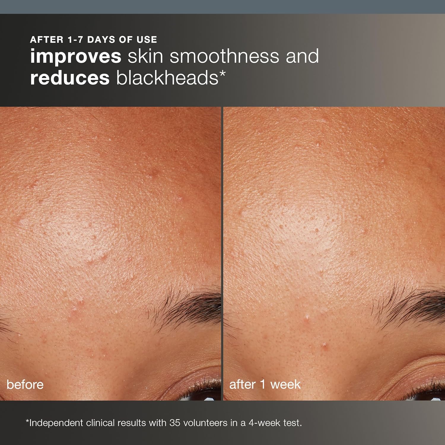 Dermalogica Daily Microfoliant, Face Exfoliator Scrub Powder with Salicylic Acid and Papaya Enzyme, Achieve Brighter, Smoother Skin Daily - Image 4